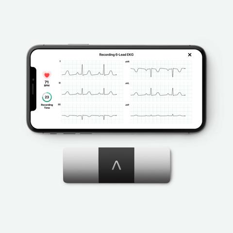 AliveCor Portable Personal EKG