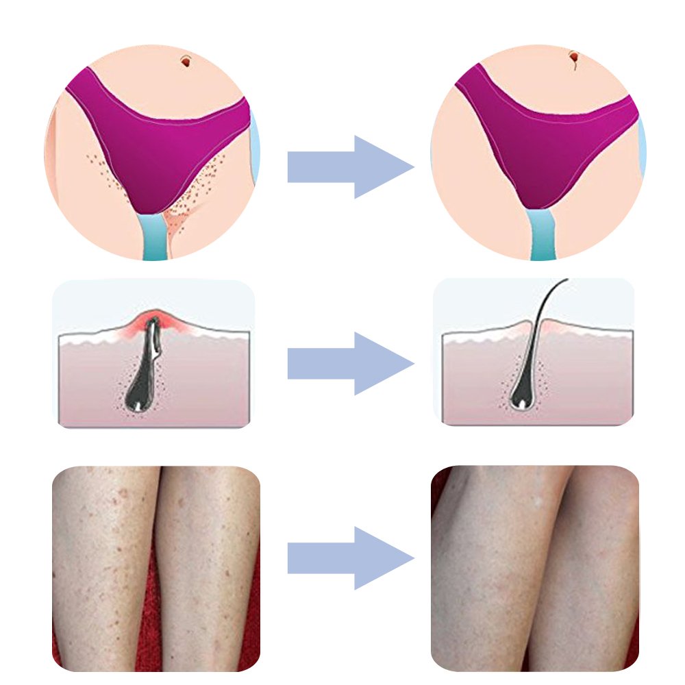 Body Brush To Treat and Prevent Razor Bumps