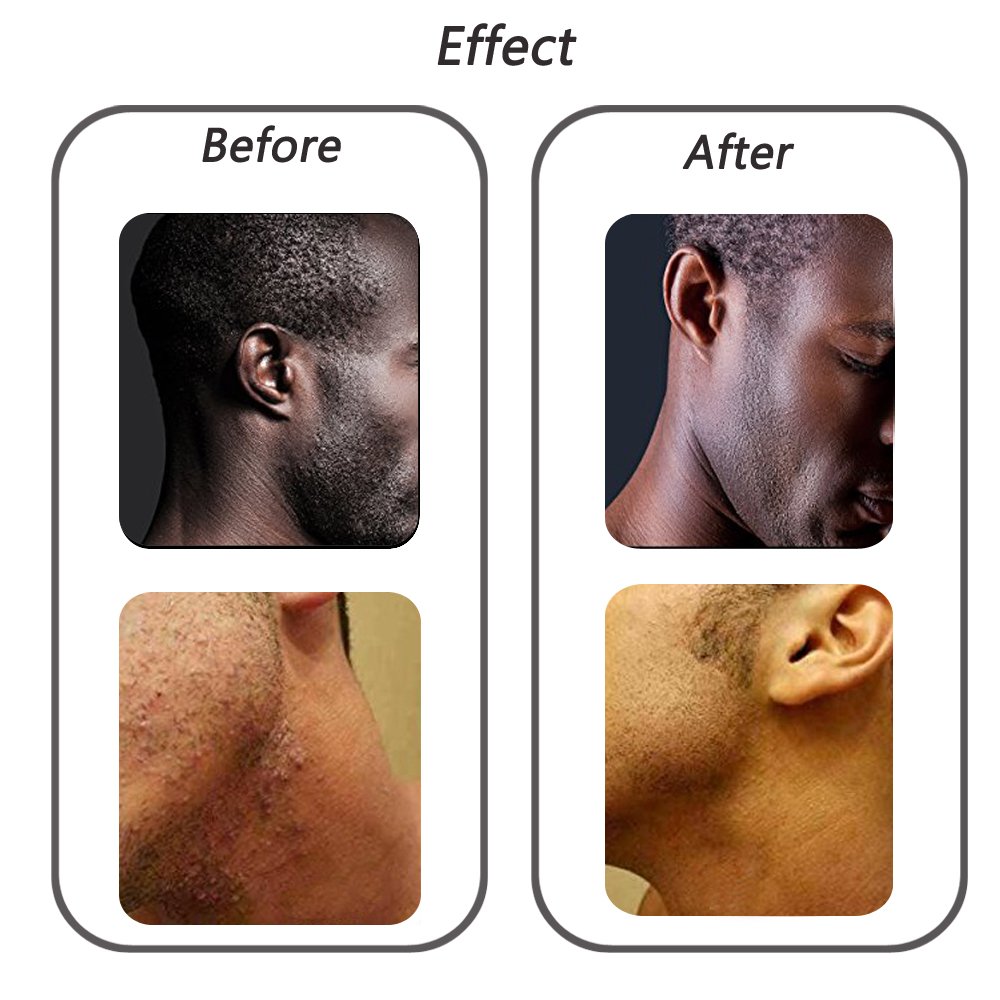 Body Brush To Treat and Prevent Razor Bumps