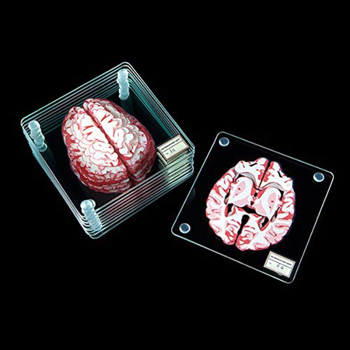 Brain Specimen Coasters