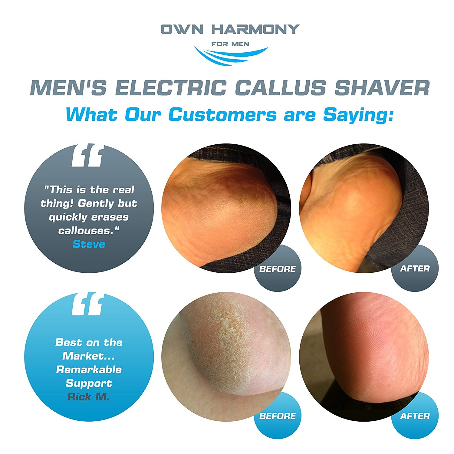 Electric Rechargeable Callus Remover
