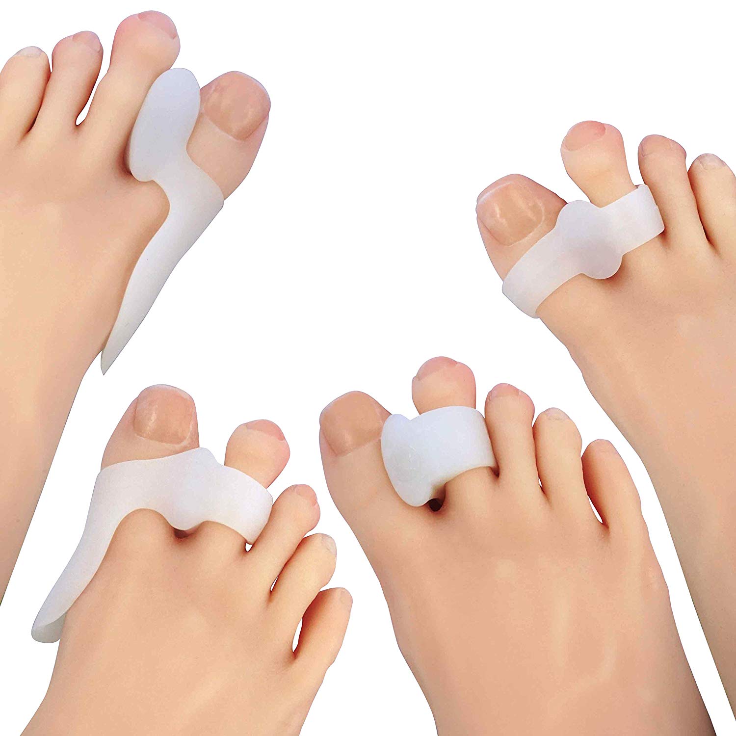 Toe Separators and Spreaders For Overlapping Toes