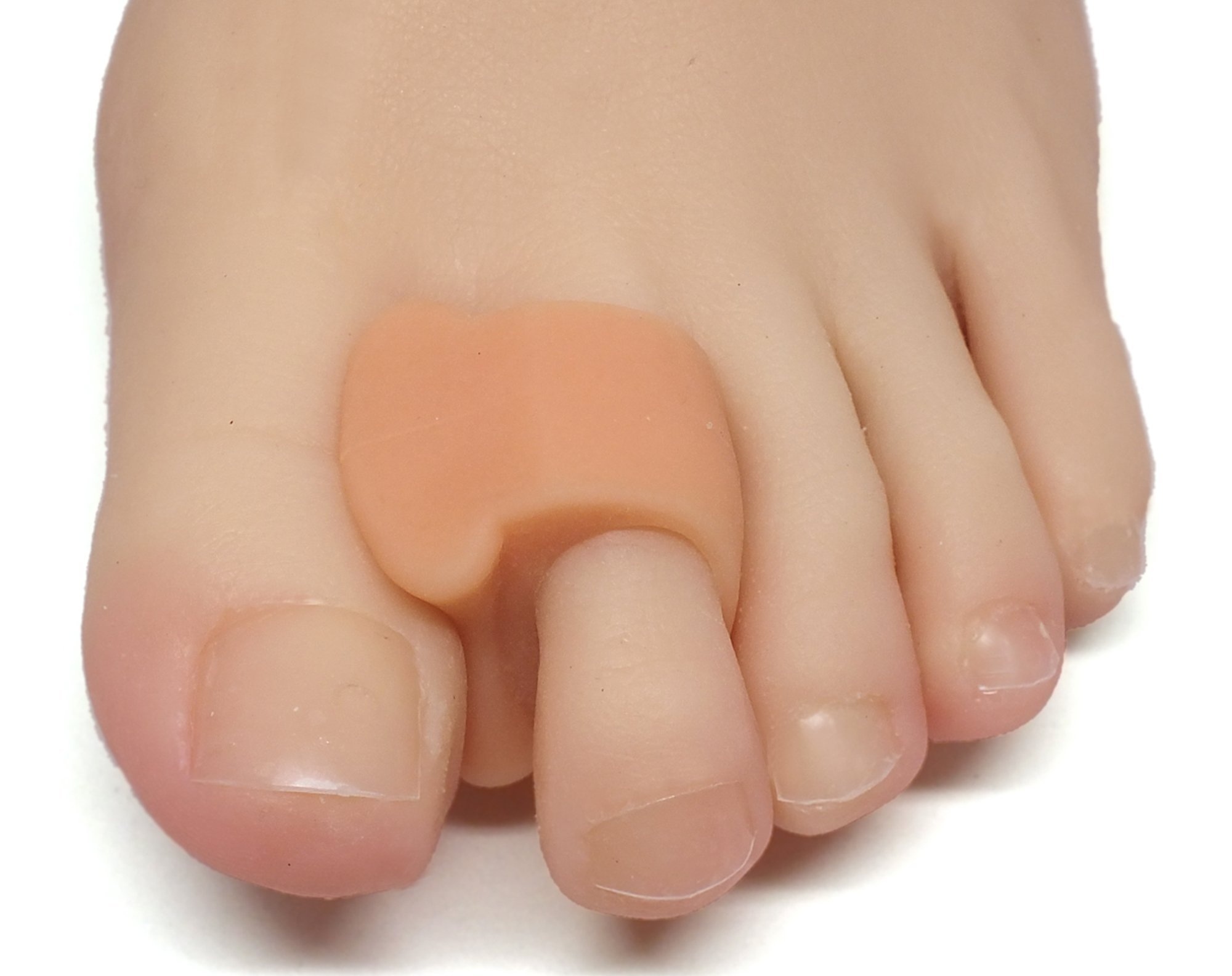 Toe Separators and Spreaders For Overlapping Toes