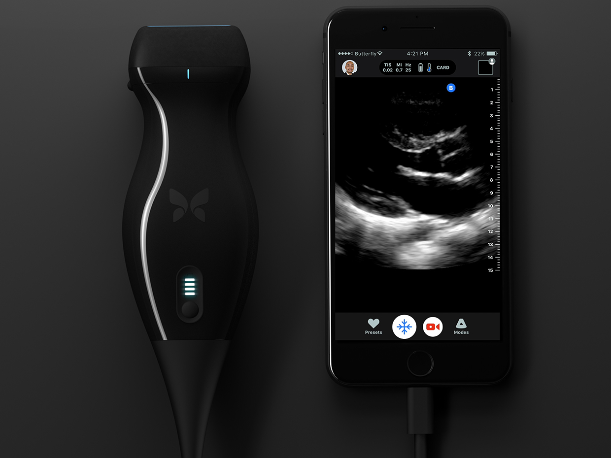 Ultrasound to Go